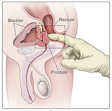Geneva reccomend womens clinical proctoscope exam