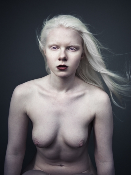best of Girl sex black albino