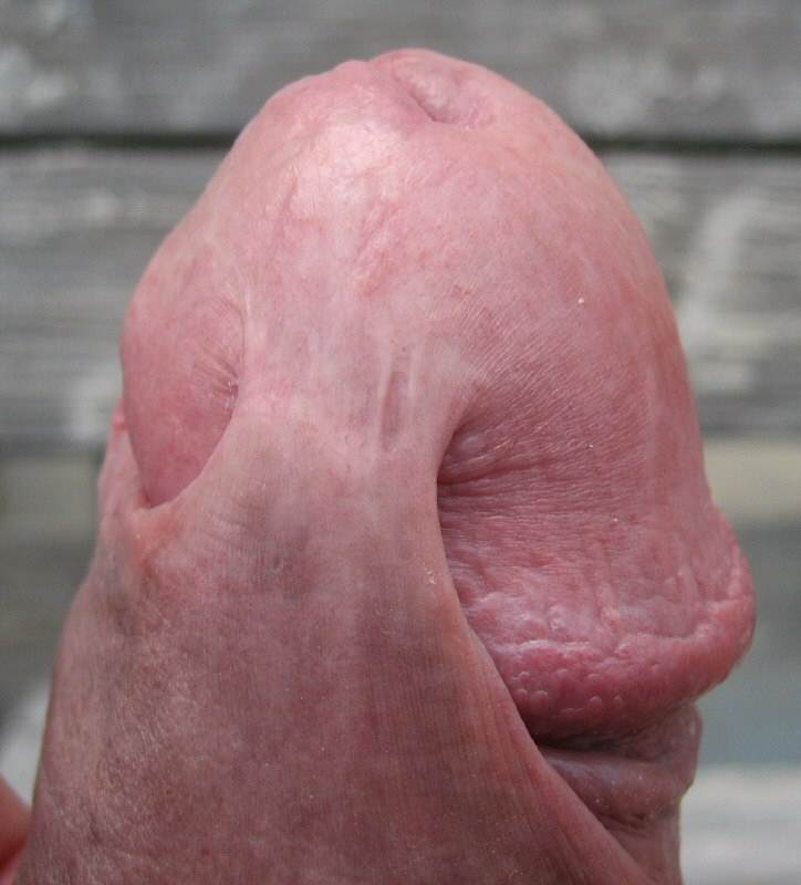 Circumcised penis extreme close